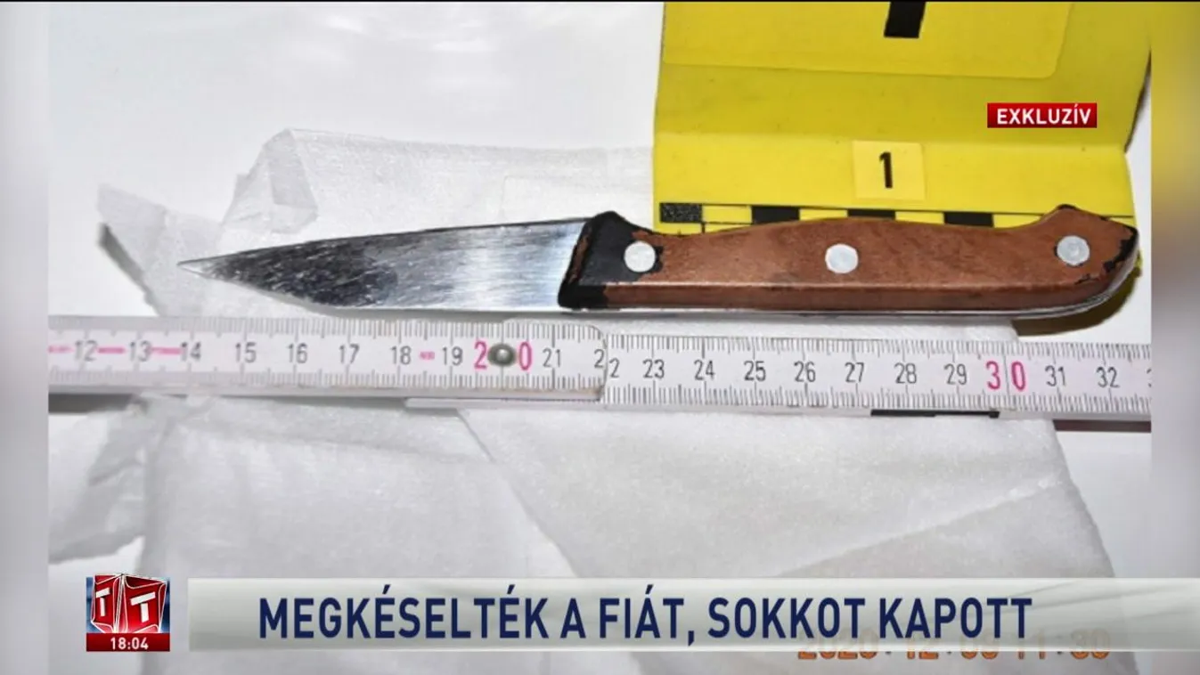 Megkéselték a fiát, sokkot kapott