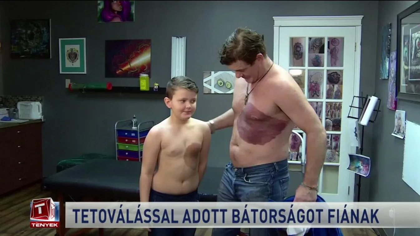 Tetoválással adott bátorságot fiának