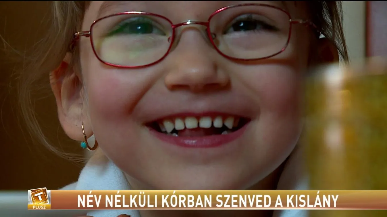 Névtelen kórban szenved - Tények Plusz 18.45