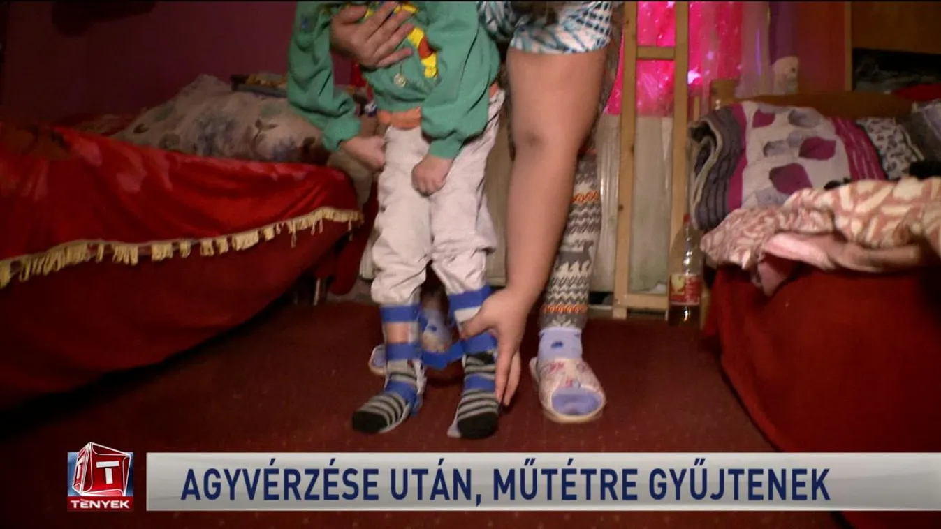 Agyvérzése után, műtétre gyűjtenek