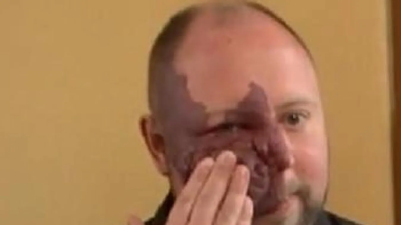 Hiába bámulják meg az utcán, semmi pénzért nem műttetné meg magát - Videó