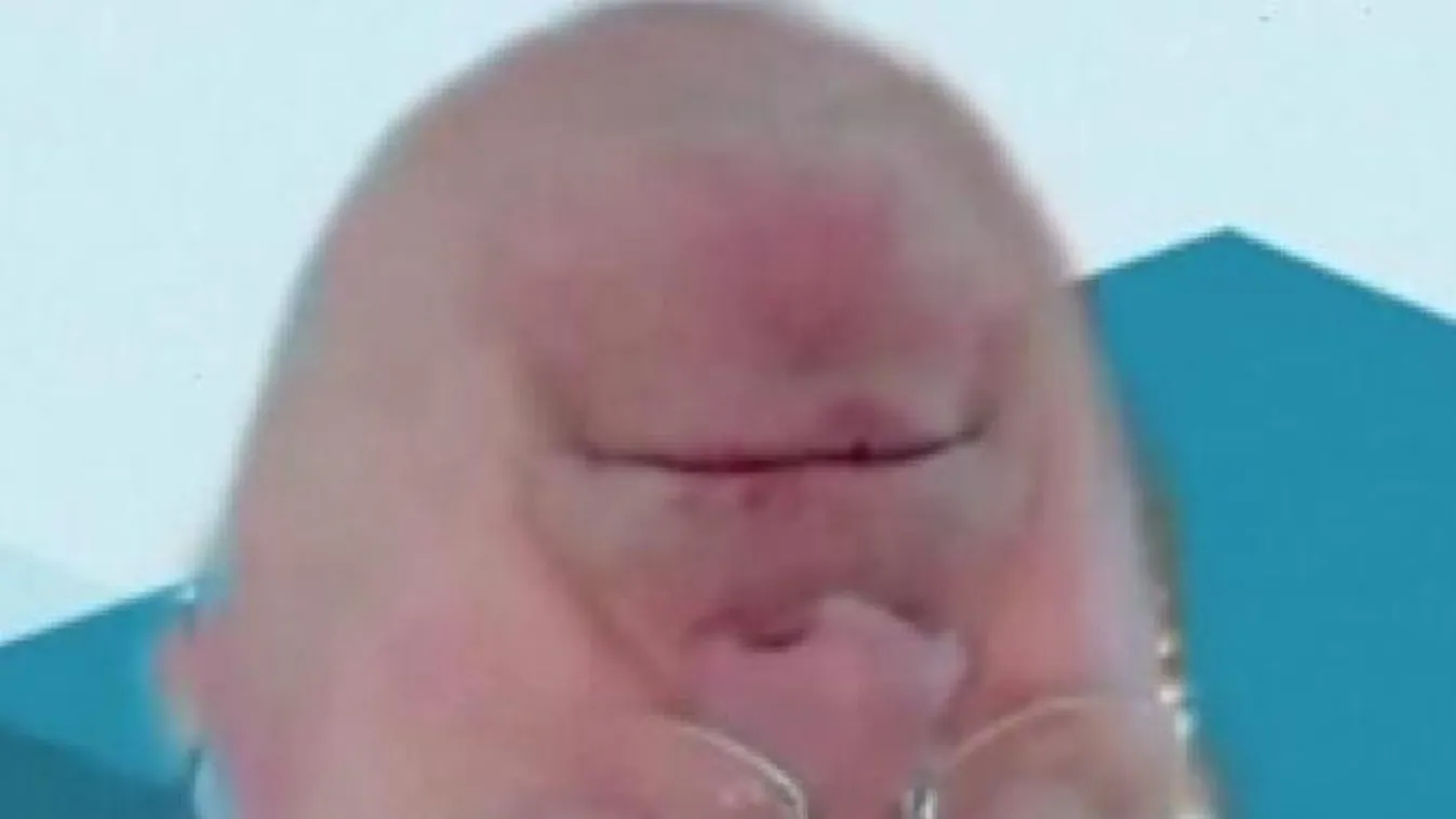 A képviselő szokatlan megjelenése miatt kellett félbeszakítani a videokonferenciát