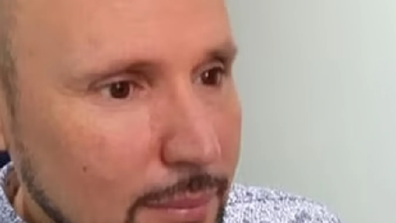 3D-s nyomtatott szemet kapott egy férfi