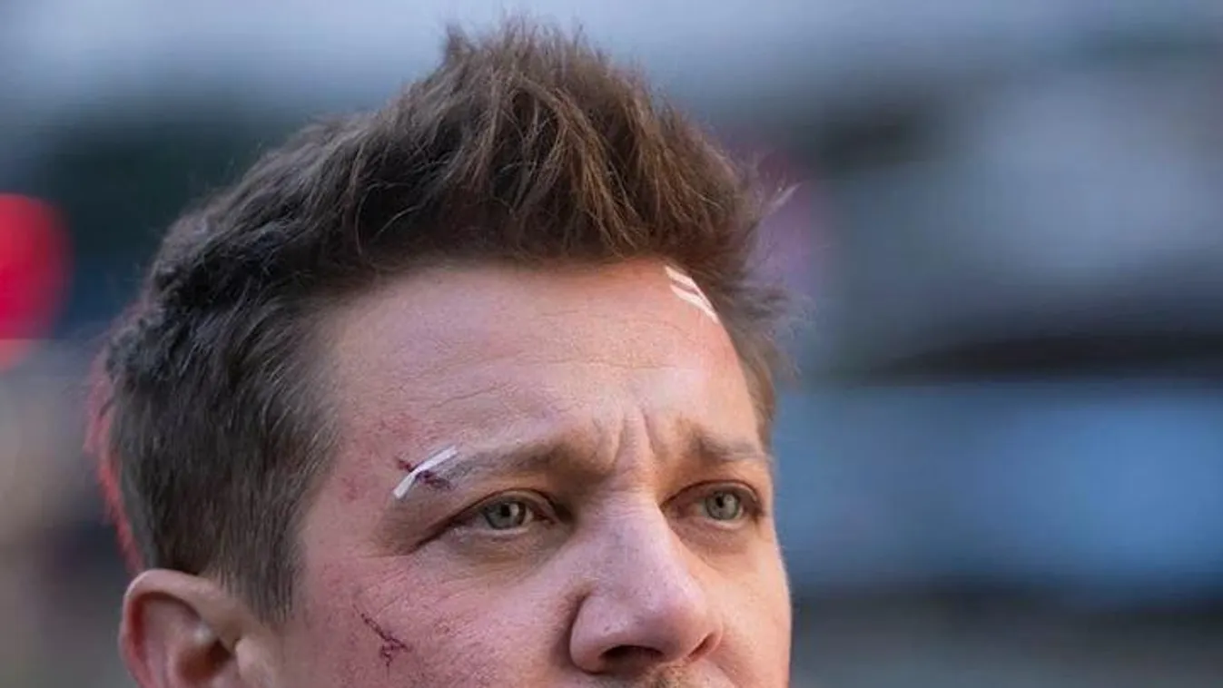 Kiderült, hogyan történt a Bosszúállók sztárjának súlyos balesete