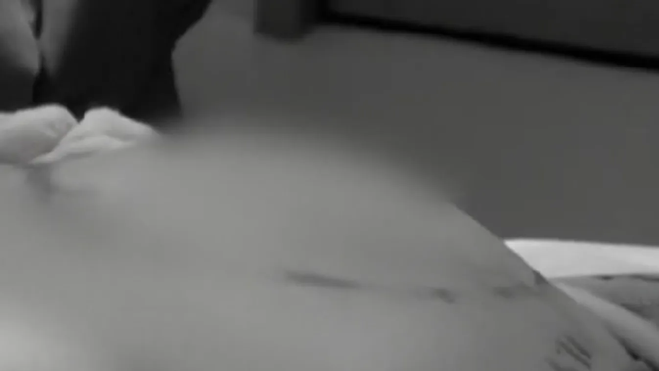 Változott a trend, már nem a mellnagyobbítás a legnépszerűbb plasztikai beavatkozás