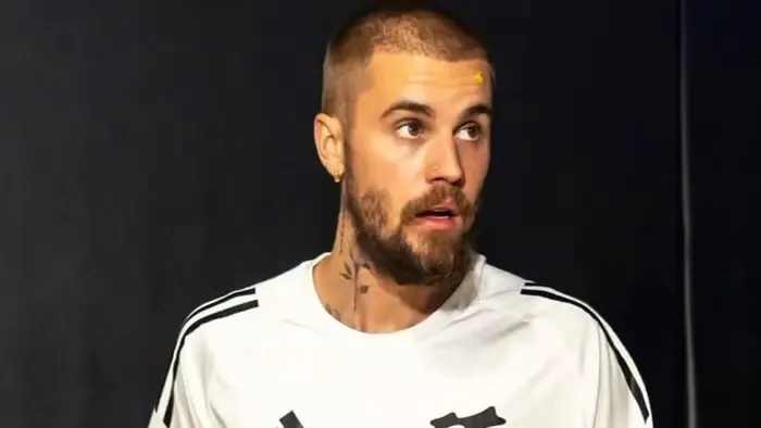 Súlyos balesetet szenvedett Justin Bieber, énekelni is alig tud