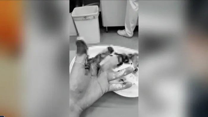 Szétroncsolta egy 15 éves fiú kezét a petárda