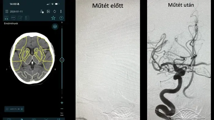 Életet mentett a mentők új, videós távdiagnosztikai rendszere