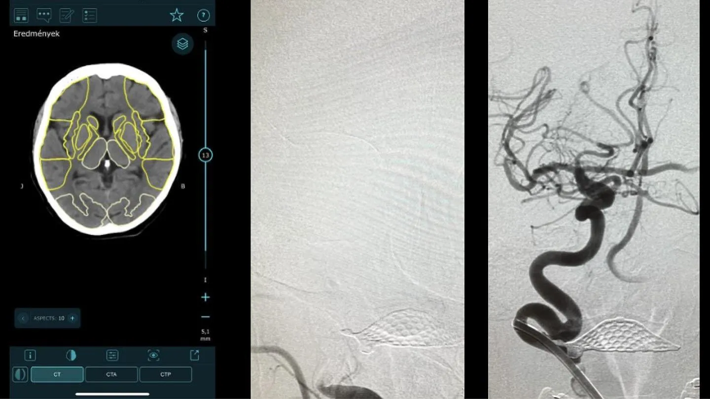 Életet mentett a mentők új, videós távdiagnosztikai rendszere