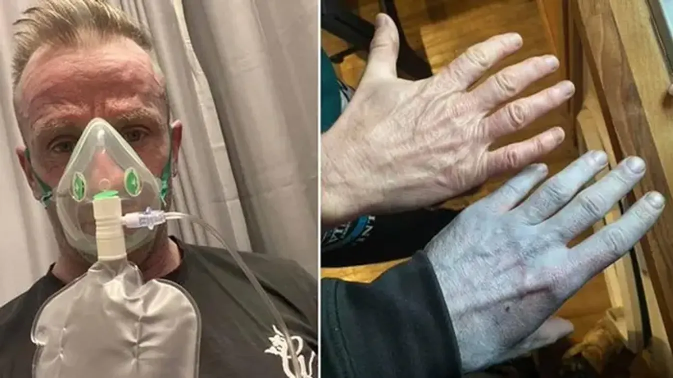 „Úgy néztem ki, mint egy Avatar” – rejtélyes tünet miatt került kórházba egy férfi