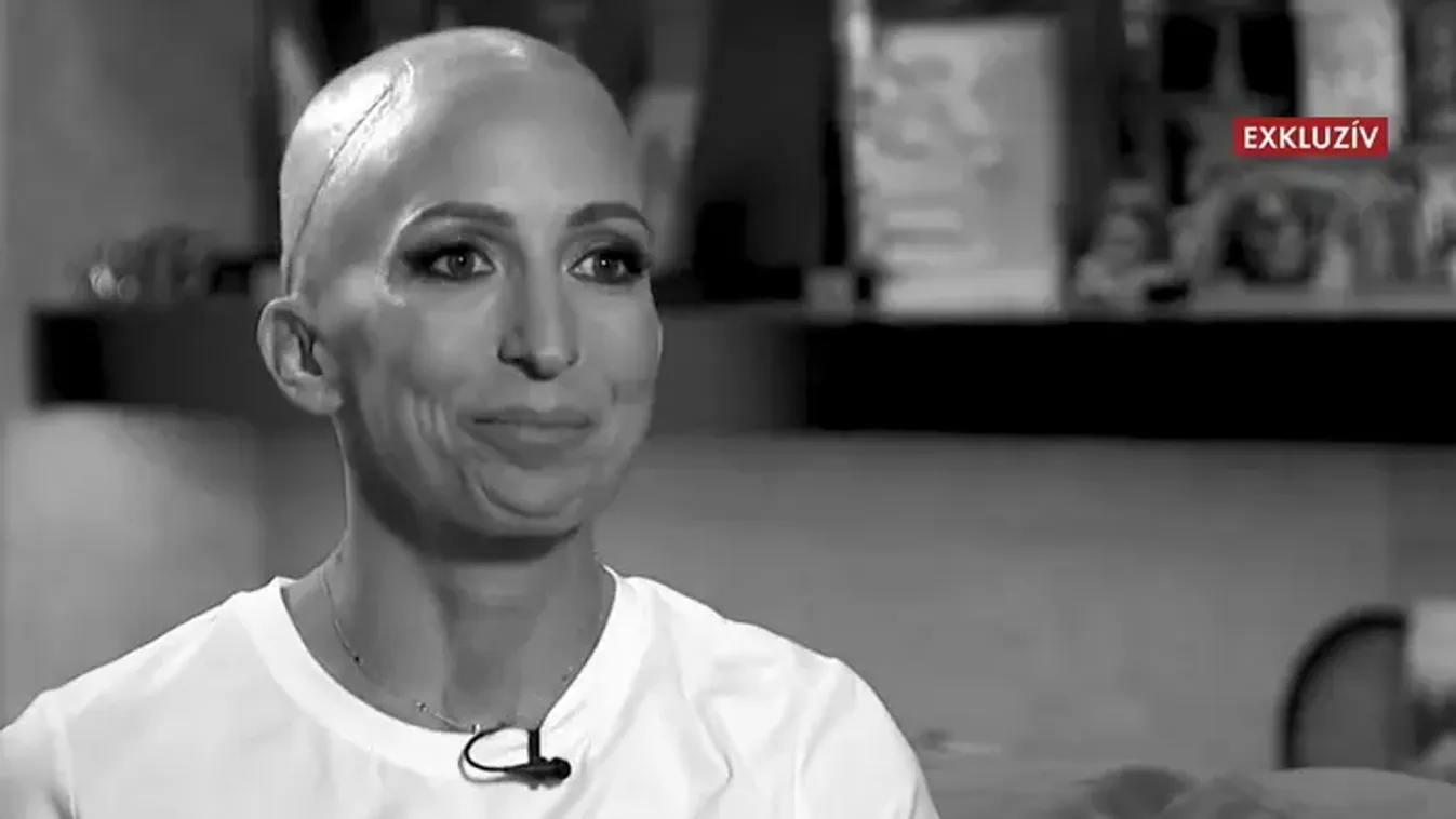 EXKLUZÍV: Rubint Réka eddig titkolta súlyos betegségét, de 4 év küzdelem után most elmondja mi az igazság