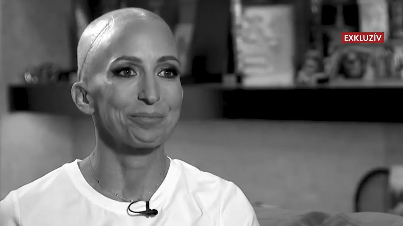 EXKLUZÍV: Rubint Réka eddig titkolta súlyos betegségét, de 4 év küzdelem után most elmondja mi az igazság