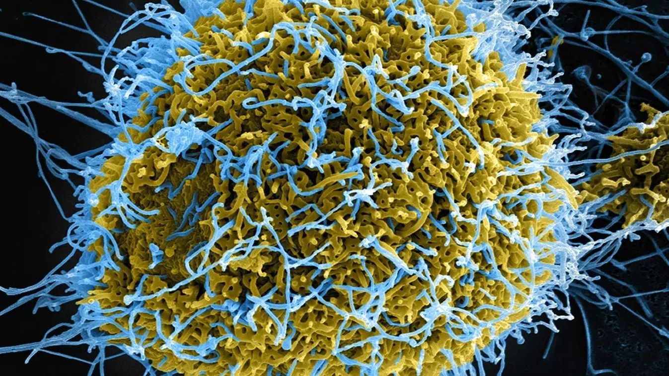 Ebola járvány tört ki a Kongói Demokratikus Köztársaságban