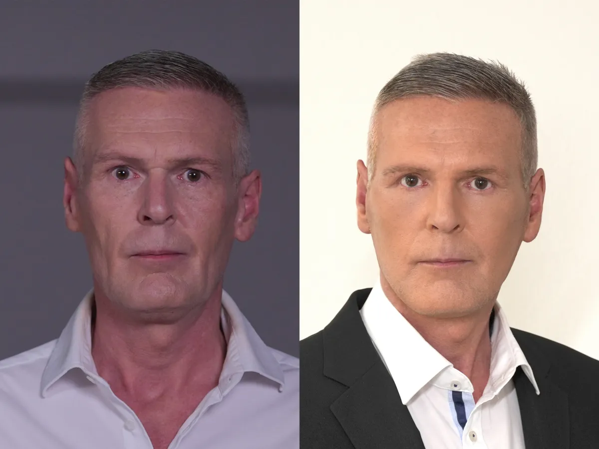 Ilyen volt és ilyen lett a magyar James Bond a plasztikai beavatkozástól